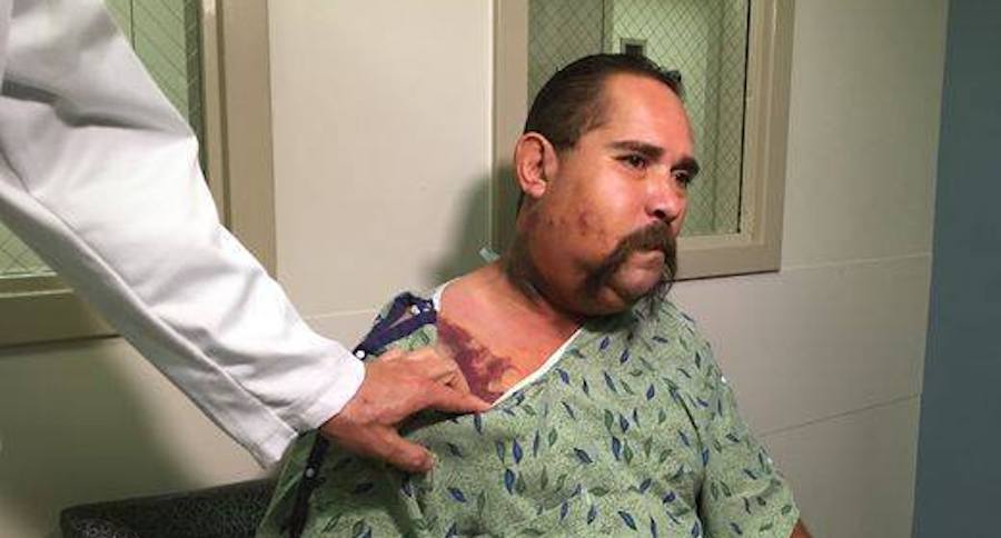 bit by rattlesnake