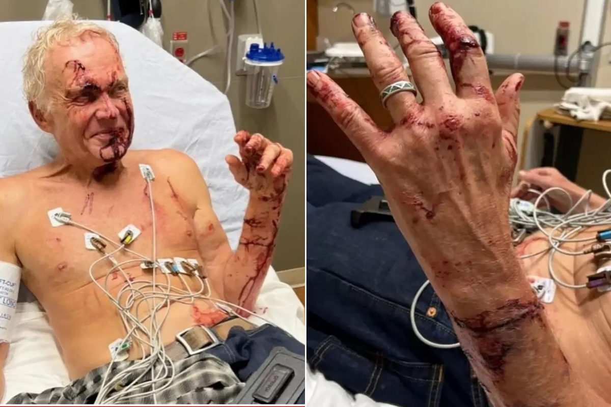 Bill Palas in the hospital with his injuries