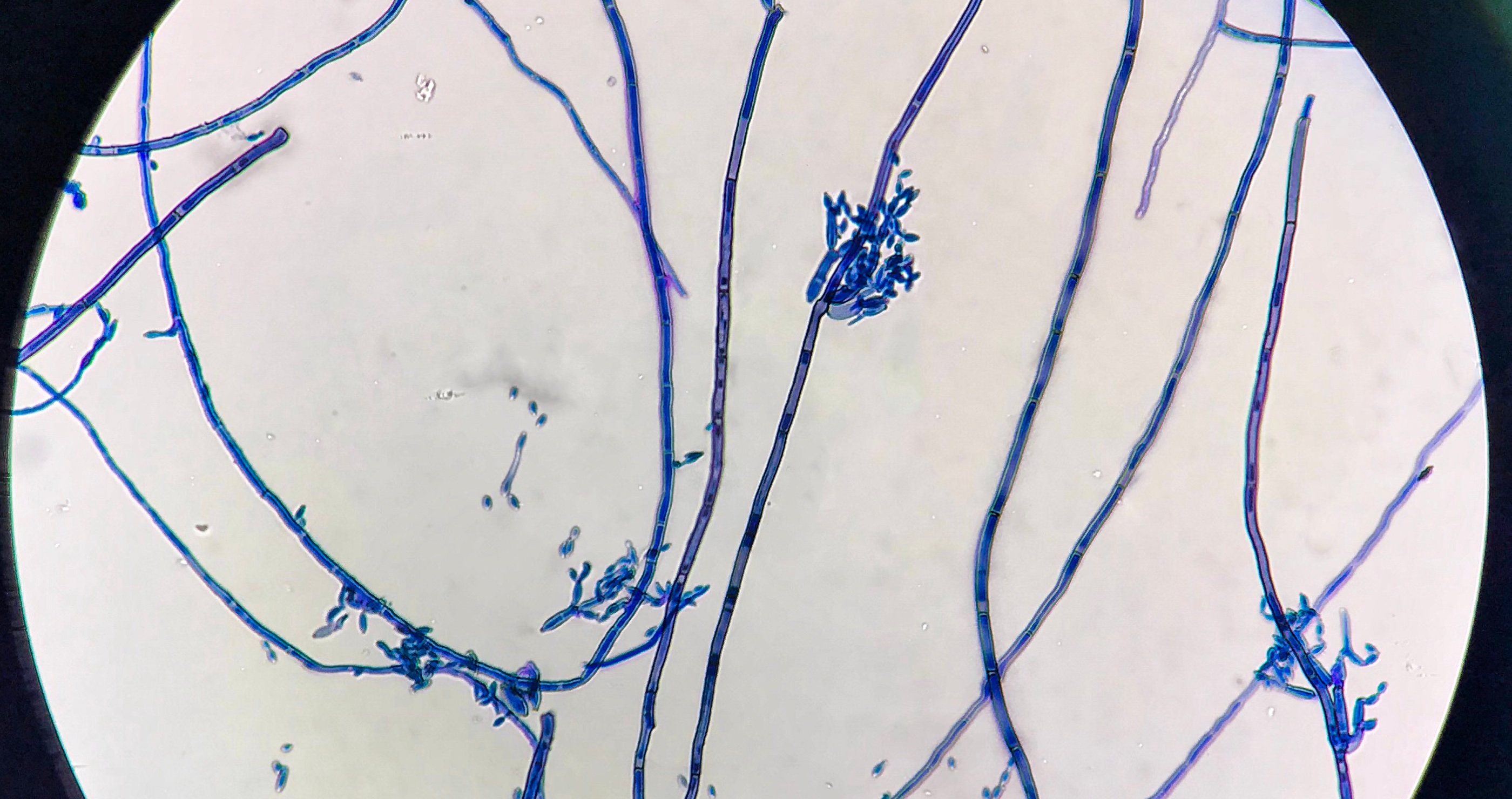 Fungus that mutates because of radiation at Chernobyl