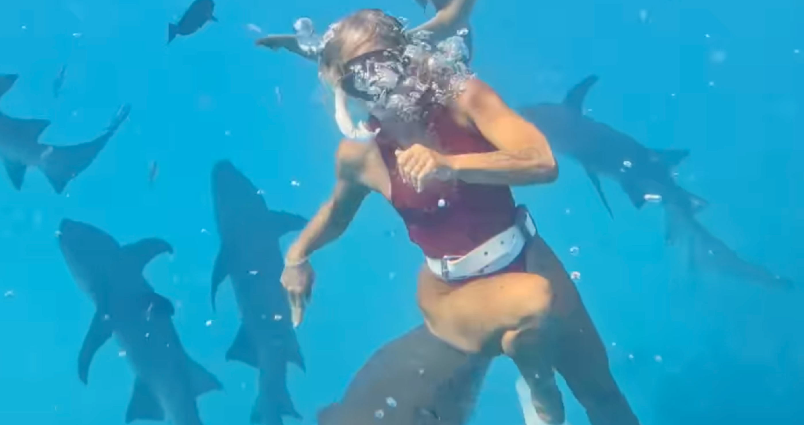 woman gets bitten by a shark but is not mad