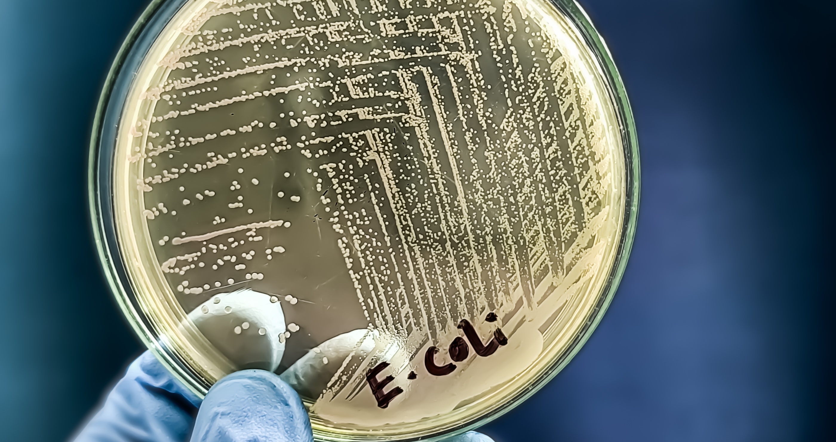 hidden dangers of the lake e coli bacteria